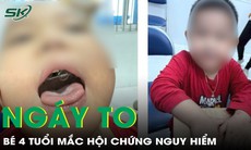 Ngáy to tưởng bình thường, bé trai 4 tuổi phát hiện mắc hội chứng nguy hiểm