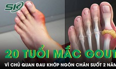 Đau khớp ngón chân suốt 2 năm nam thanh niên 20 tuổi mắc gout