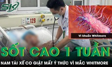 Sau một tuần sốt cao, nam tài xế 54 tuổi phát hiện mắc Whitmore