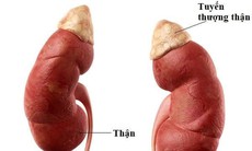 Nhận biết sớm dấu hiệu suy tuyến thượng thận ở trẻ