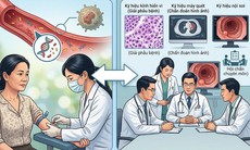 Xét nghiệm ctDNA có quyết định việc hóa trị sau mổ ung thư đại tràng?