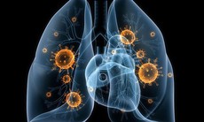 Viêm phổi do Adenovirus ở trẻ: Nhận biết sớm dấu hiệu nguy hiểm