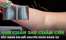 Đau chân dữ dội sau châm cứu, người phụ nữ sốc nặng khi biết nguyên nhân