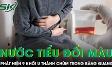 Nước tiểu chuyển màu, phát hiện 9 khối u thành chùm trong bàng quang