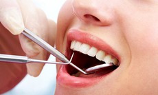 Những thói quen âm thầm làm hỏng răng