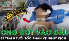 Chỉ vài phút sau khi bị ong đốt vào đầu, bé trai 8 tuổi sốc phản vệ