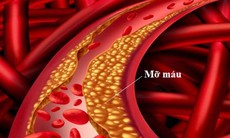 5 lưu ý khi điều trị mỡ máu tại nhà