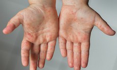Dung dịch sát khuẩn tay chân miệng cho trẻ loại nào an toàn, giá tốt?