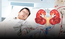 Mới 16 tuổi đã suy thận cấp, chi chít sỏi đầy hai quả thận