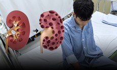 Ông bố trẻ 24 tuổi chết lặng khi nhận kết quả suy thận giai đoạn cuối 