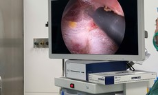 Phẫu thuật nội soi tuyến giáp – thêm lựa chọn cho bệnh nhân tại BV Bạch Mai cơ sở Ninh Bình