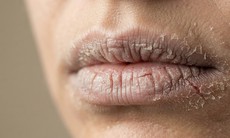 Lý do môi khô, da môi dễ bong vào mùa thu và cách khắc phục