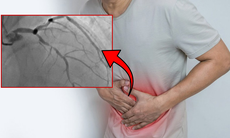 Đau thượng vị, người đàn ông phát hiện 3 nhánh mạch vành tổn thương nặng