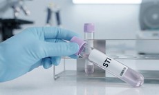 Xét nghiệm STI là gì và khi nào nên xét nghiệm?