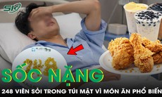 248 viên sỏi trong túi mật nam thanh niên 26 tuổi