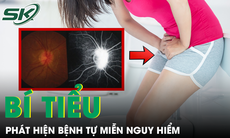 Bí tiểu kéo dài, người phụ nữ phát hiện bệnh tự miễn nguy hiểm