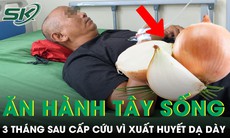 Ăn hành tây sống mỗi ngày chống ung thư, người đàn ông phải đi cấp cứu