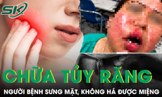 Sau điều trị tủy răng, người bệnh đái tháo đường sưng mặt, không há được miệng