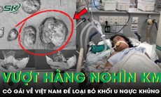 Vượt hàng nghìn km từ Cộng hòa Séc về Việt Nam loại bỏ khối u ngực khủng