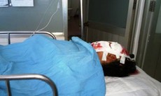 Cứu sống nạn nhân bị xà beng đâm xuyên đầu