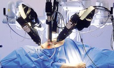 Robot phẫu thuật có thay thế được con người?