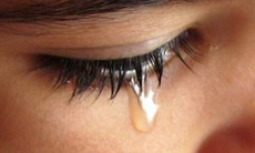 Chảy nước mắt sống và cách khắc phục