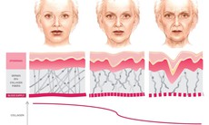 Collagen làm đẹp da: Từ quảng cáo đến thực tế