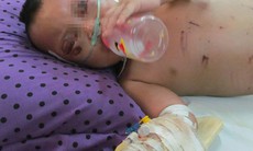 Bé trai 2 tuổi đầy thương tích nghi do bà ngoại đánh