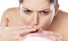 5 bí kíp xử lý đám ria mép khó chịu dành cho con gái