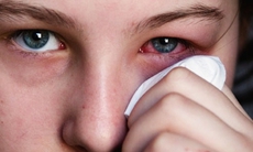 Dược thiện trị đau mắt đỏ
