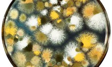 Bệnh nấm sâu Aspergillus có nguy hiểm?