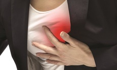 Hội chứng đau thần kinh liên sườn