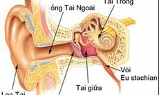 Vì sao viêm tai giữa hay tái phát ?