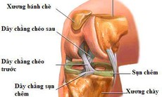 Tổn thương dây chằng có gây biến chứng?