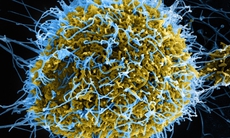 Khám phá đường lây nhiễm của virus Ebola