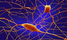 Thế nào là u sợi thần kinh?