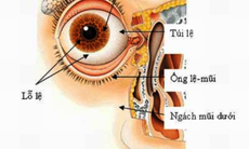 Viêm túi lệ do tắc nghẽn lệ đạo