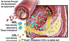 Mối liên quan giữa cholesterol và ung thư