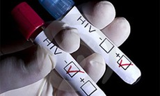 Vi phạm quy định về xét nghiệm HIV, xử lý thế nào?