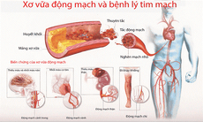 Hút thuốc lá làm giảm khả năng sinh sản của nam giới