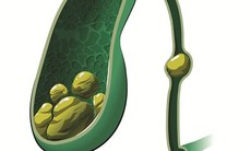 Cẩn thận với bệnh của túi mật