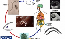 Giun móc và giun mỏ - Kẻ hút máu đáng ghét