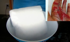 Tại sao đá khô lại nguy hiểm?