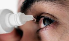 11 điều không thể bỏ qua về bệnh đau mắt đỏ