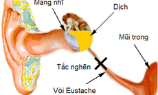 4 biến chứng thường gặp khi bé bị cảm lạnh