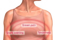 Đau vú có đáng sợ?