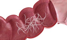 Hiểu rõ về thuốc diệt giun để dùng cho đúng