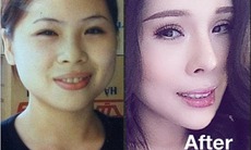 12 lần dao kéo để trở thành hotgirl