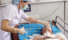 Nhập viện vì ngộ độc rượu và hóa chất