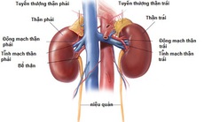 Viêm cầu thận cấp có nguy hiểm?